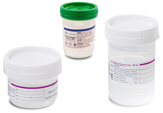Pre-filled Specimen Containers